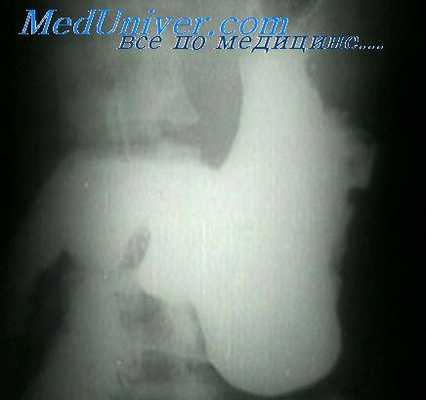 болезни желудочно-кишечного тракта