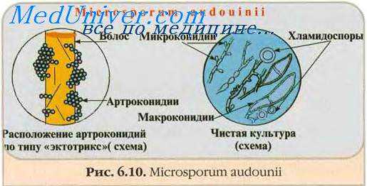Клиника дерматомикозов. Симптомы дерматомикозов. Клиника эпидермафитий