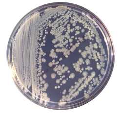 enterobacter cloacae