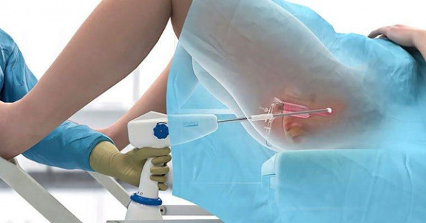 Железистая гиперплазия эндометрия