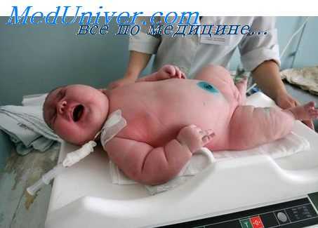 диагностика ишемии миокарда