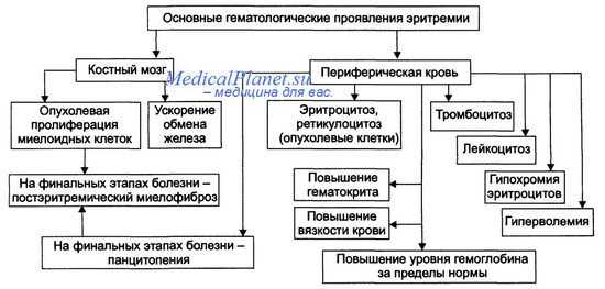 клиника эритремии