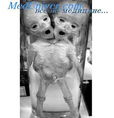 генные болезни плода