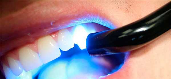 Люминесцентная диагностика