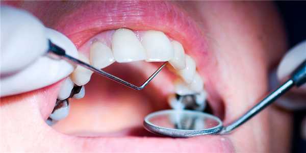 Зондирование