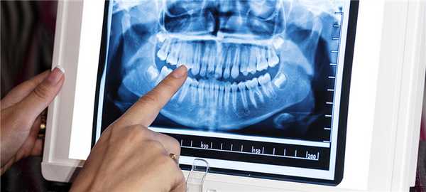 Рентгенологическое обследование