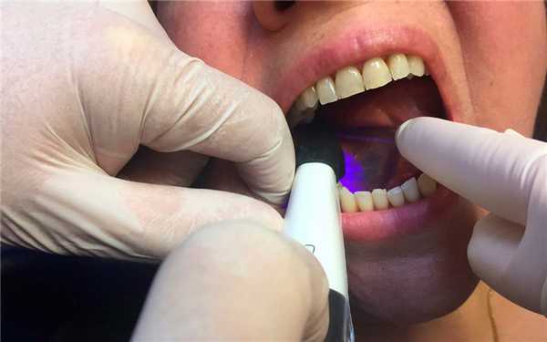 Оптический маркер