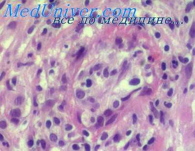 ку лихорадка