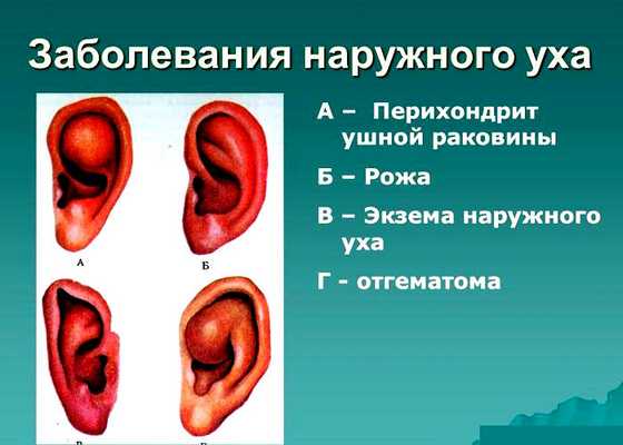 Болезни уха