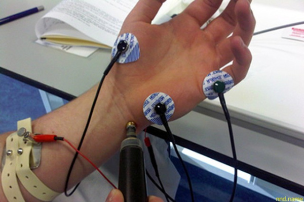 Электростимуляция