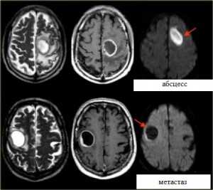 Диффузия-обр