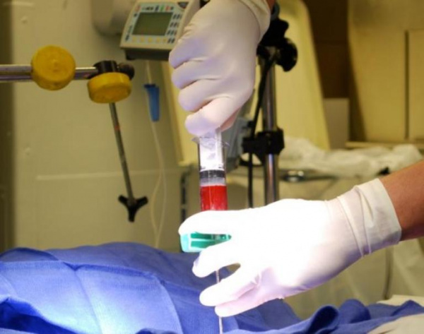 Панцитопения