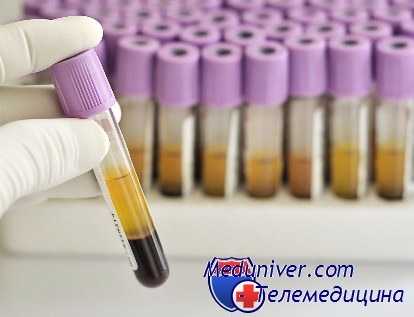 коагулограмма в норме