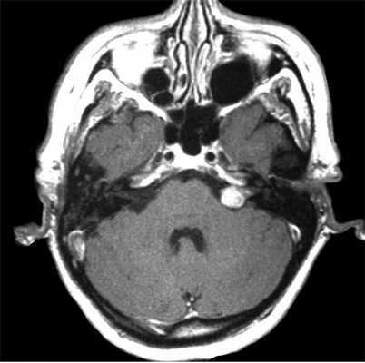 Т1-контр-акс