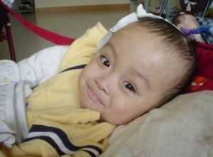 нормотензивная гидроцефалия