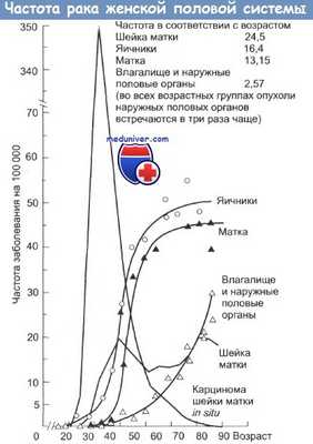 Частота рака женской половой системы