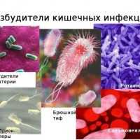 Острая кишечная инфекция