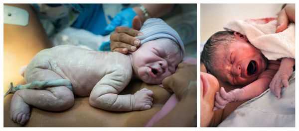 Внешний вид переношенных младенцев