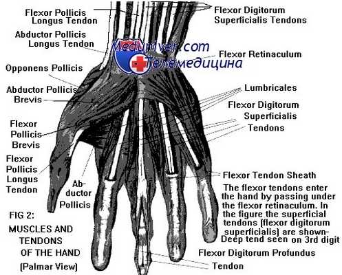 травма сухожилий сгибателей кисти