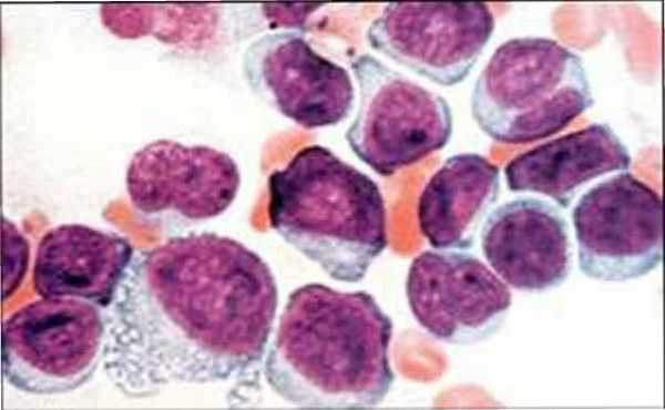 Клетки-мегалобласты