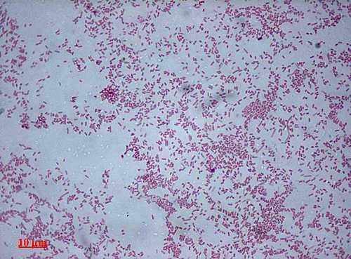 Протей мирабилис (лат. Proteus mirabilis) 