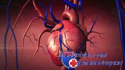 лечение разрыва сердца