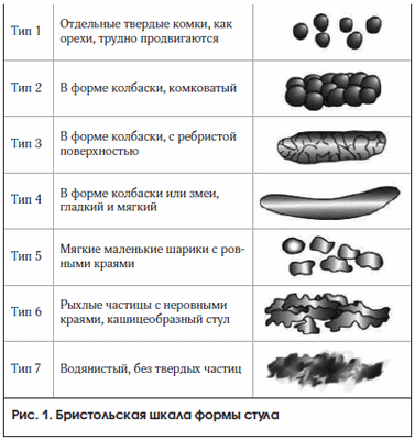 Рис. 1. Бристольская шкала формы стула