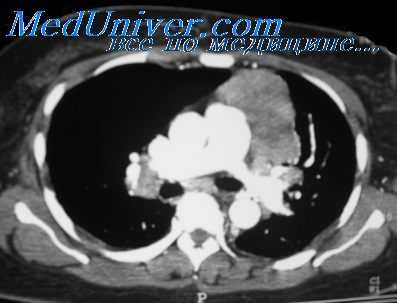 строение тимом