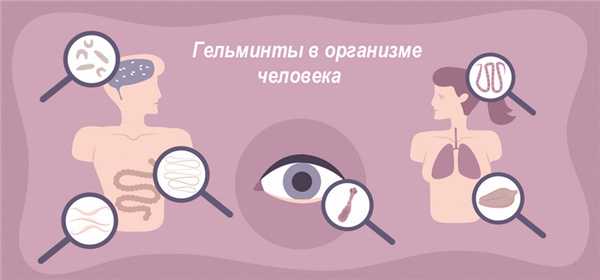 Токсокароз у детей