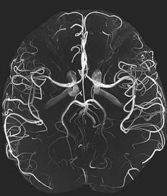 Магнитная диагностика цереброваскулярных патологий