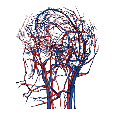 КТ ангиография интракраниальных артерий