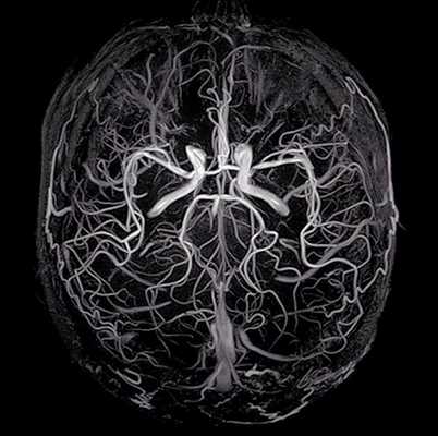 3D-модель церебральных артерий и вен