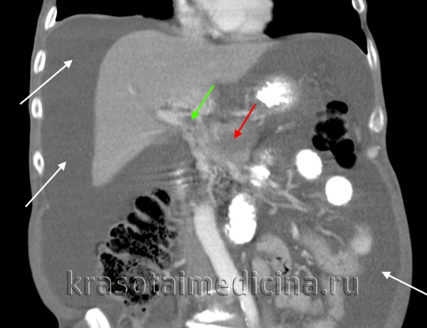 Васильев Роман Владимирович, гастроэнтеролог, гепатолог, врач общей практики - Санкт-Петербург