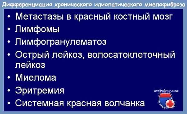 диагностика хронического идиопатического миелофиброза