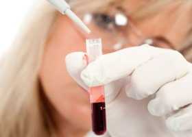 Анализы и диагностика