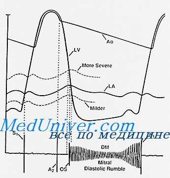 органические шумы сердца
