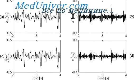 шумы сердца