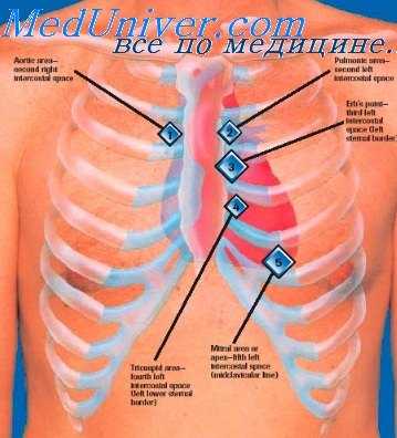 диастолические шумы сердца