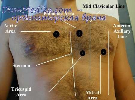 аускультация сердца