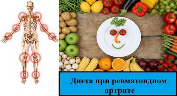Диета при артрите
