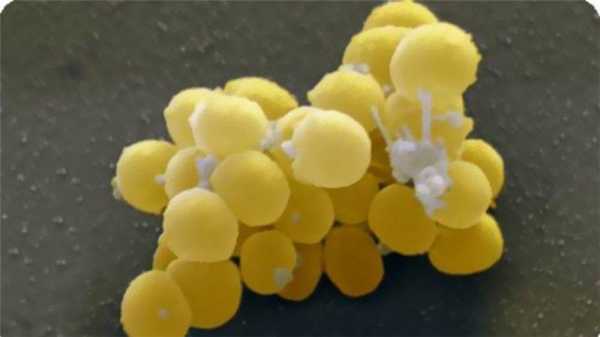 золотистый стафилококк