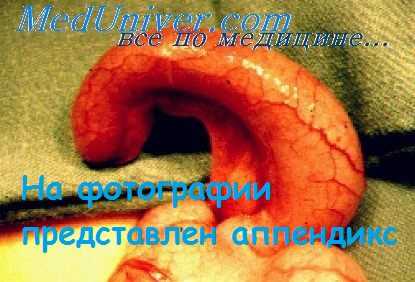 острый аппендицит у детей