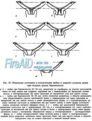 Продолжительность патологического прелиминарного периода. Этиология клиники прелиминарного периода.