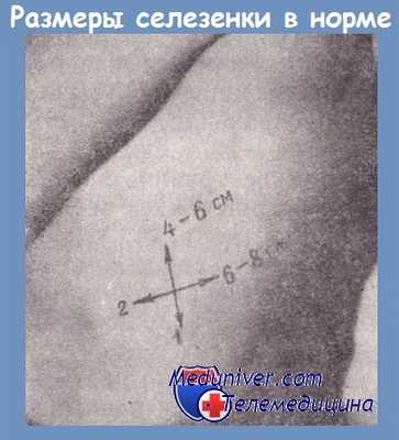 Размеры селезенки в норме у взрослых
