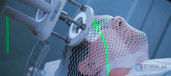 Диагностика опухоли головного мозга при проявлении первых признаков