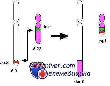 генетика хронического миелолейкоза