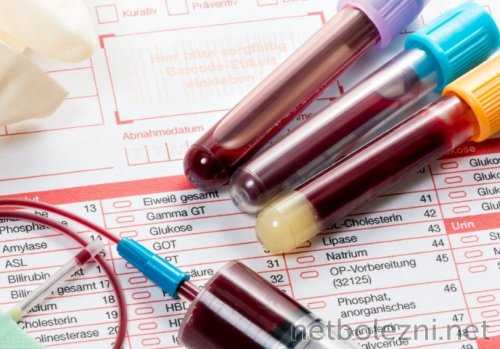 Общий анализ крови