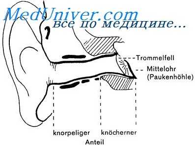 отогенный абсцесс