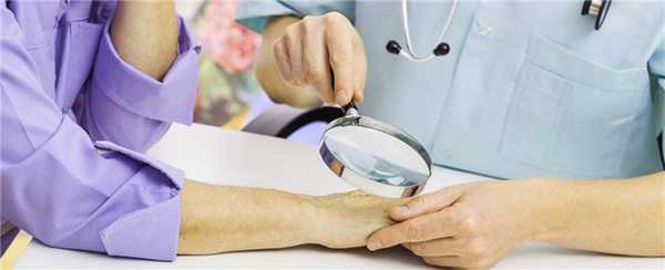 Отличия экземы от дерматита