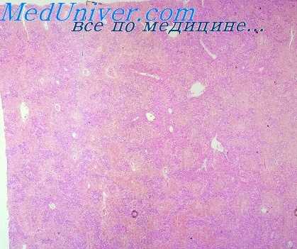 дерматит и экзема